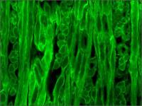 Dystrophin antibody [MANDYS8]