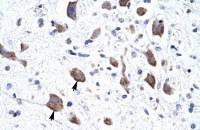 CLCN3 antibody, C-term