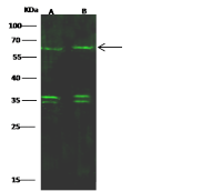 SOX11 antibody