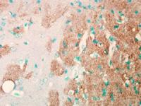 Nav1.7 antibody [S68-6]