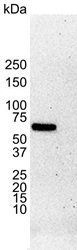 Estrogen Receptor alpha antibody [6F11]