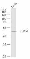 SLC52A3 antibody