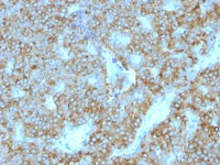 Parathyroid Hormone antibody [PTH/1175]
