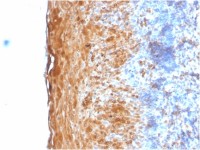 Involucrin antibody [IVRN/2113R]