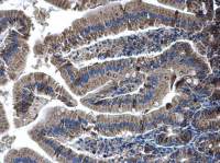 Glutaminase C (GAC) antibody