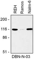 Drebrin antibody [DBN-N-03]