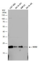 SOD2 antibody