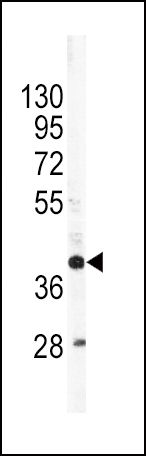Apolipoprotein L1 antibody, C-term