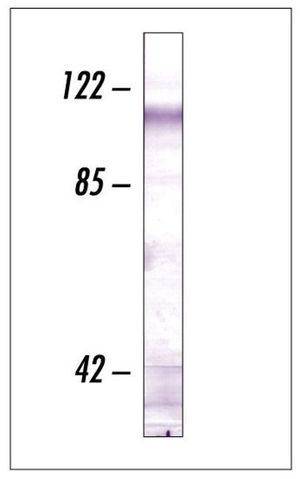 CDH11 antibody [5B2H5]