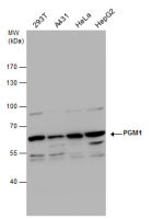 PGM1 antibody