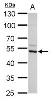 ADC antibody [N2C2], Internal