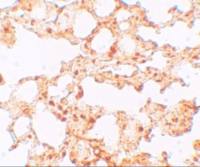 SLC39A6 antibody