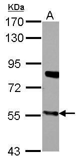 CYP27A1 antibody
