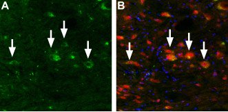 MCOLN3 antibody