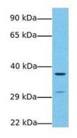 Wnt7b antibody, Internal
