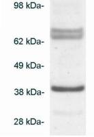 BLVRA antibody