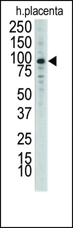 DDR1 antibody