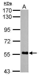 FBXO7 antibody