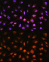 GADD153 antibody