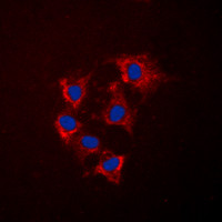 COL4A5 antibody