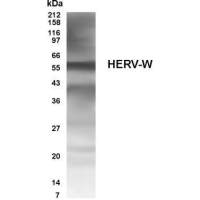 Human Endogenous Retrovirus antibody