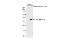 SQSTM1 / P62 antibody [GT1193]