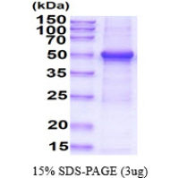 Human TUBG1 protein, His tag