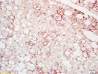 CLMP antibody