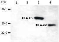 HLA-G antibody [5A6G7] (PE)