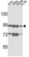 ABCB5 antibody, N-term
