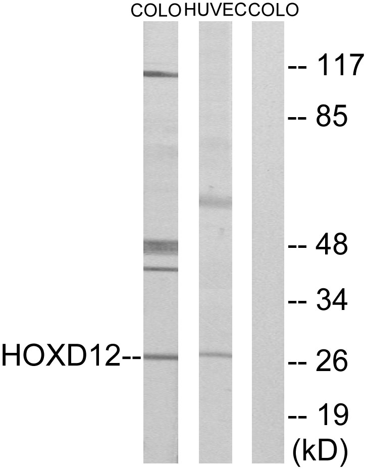 HOXD12 antibody