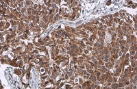 HSD3B1 antibody [N1C1]