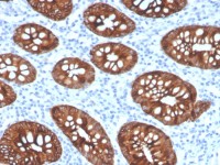 Cytokeratin 8 antibody [KRT8/4067R]