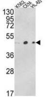 ACTR3B antibody, C-term