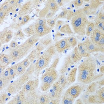 Flavin reductase antibody