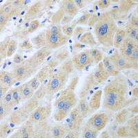 Flavin reductase antibody