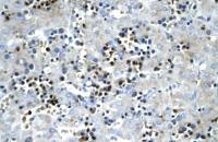 SCD antibody, Internal