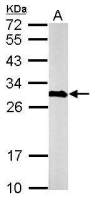 Calretinin antibody