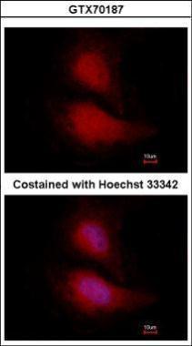 FOXO1 antibody [14E4]