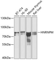 hnRNP M antibody