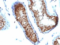 SUMO2 antibody [SUMO2/1199]