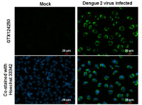 Dengue virus NS4B protein antibody