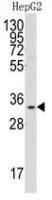 C1qBP antibody, Internal