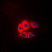 p130Cas (phospho Tyr249) antibody