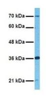 Glypican-3 antibody, Internal