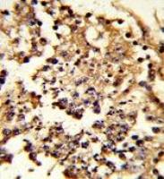 HSP105 antibody, Internal