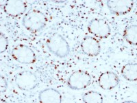 SOX4 antibody [SOX4/2540]