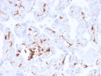Factor XIIIa antibody [F13A1/3772R]
