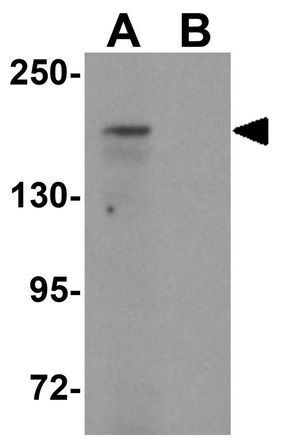 ATP2C1 antibody