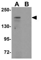 ATP2C1 antibody